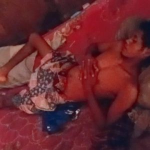 8 Bulan Terbaring Sakit, TKI Asal Bima Ini Ingin Pulang Kampung Tak Punya Uang