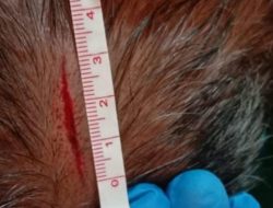 Pukul Korban Pakai Gagang Parang Hingga Robek Kepala, Pria Berinisial AS Diamankan Polsek Muara Telang